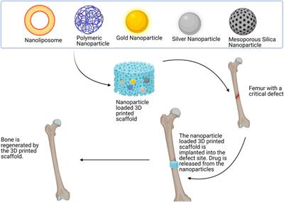 The Application of 3D-Printing and Nanotechnology for the Targeted Treatment of Osteosarcoma